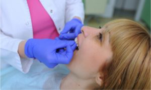 A dentist placing veneers on a patient's teeth.